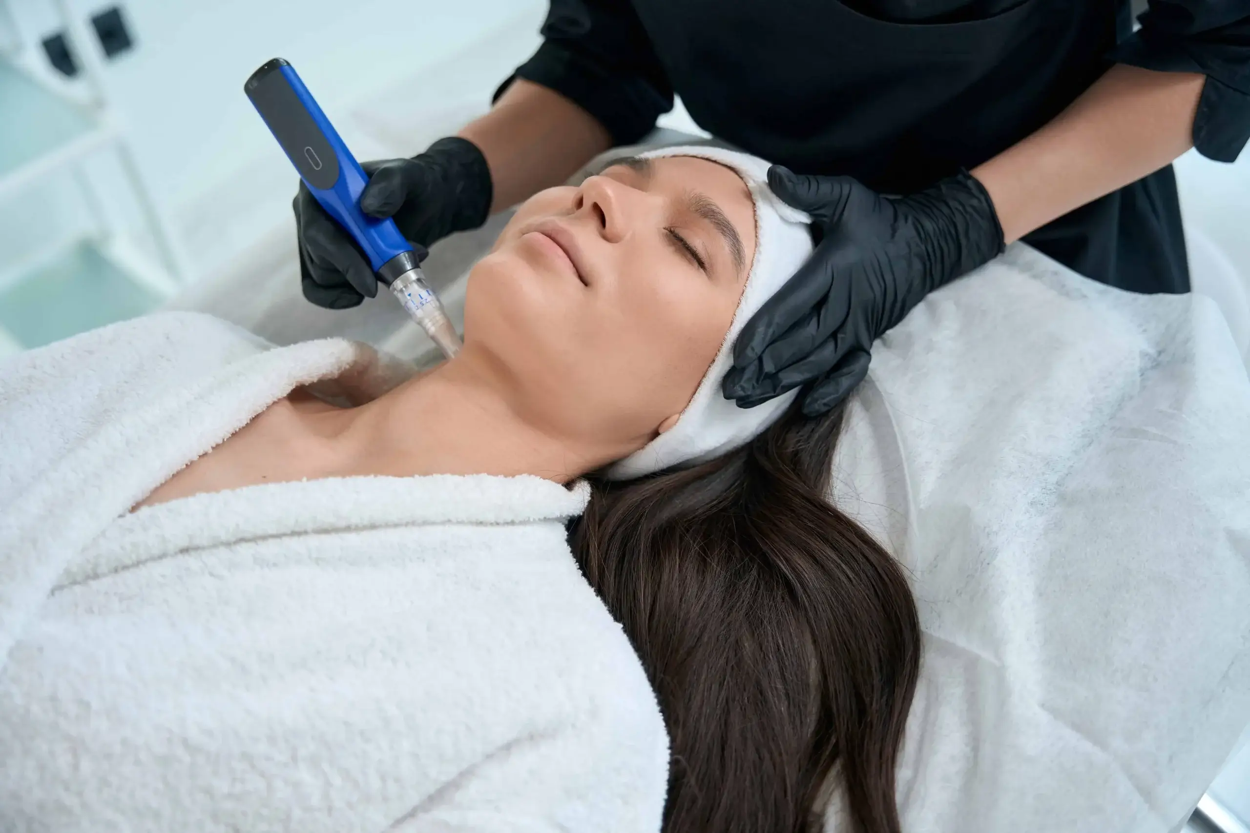 Microneedling in Riverside, CA - Haus of Well