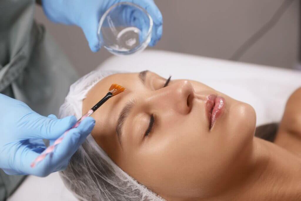 Chemical Peel with VI Peel _ Haus of Well, PC _ Riverside CA