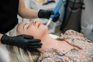 Microneedling with PRP in Riverside, CA by Haus of Well