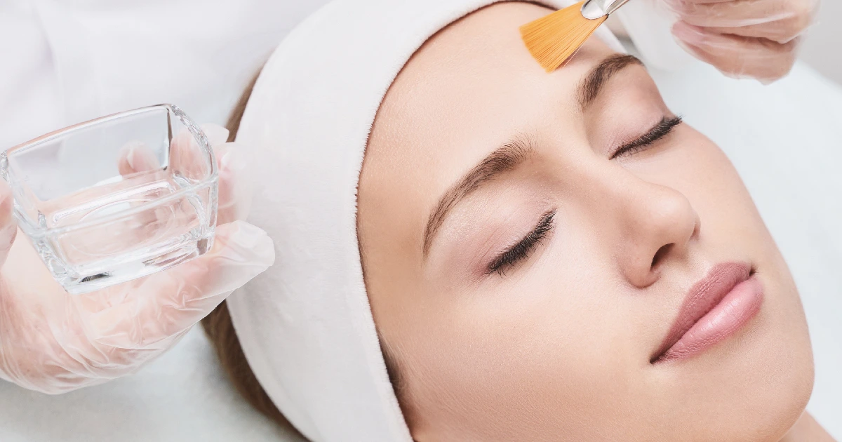 A woman receiving Chemical Peels in Riverside, CA