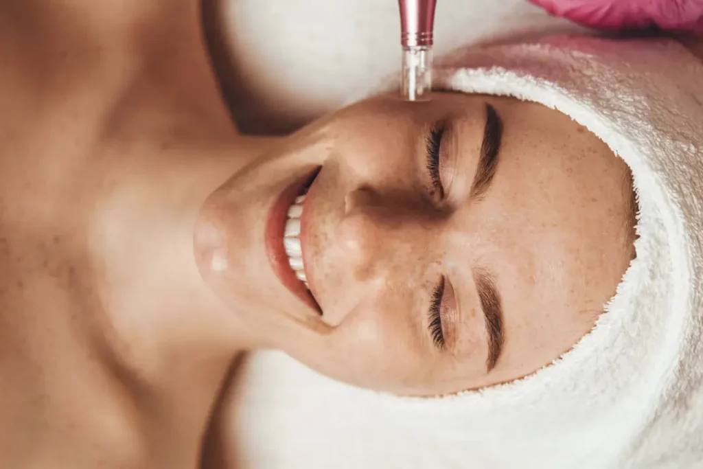 Step-by-Step Medical Microneedling Procedure