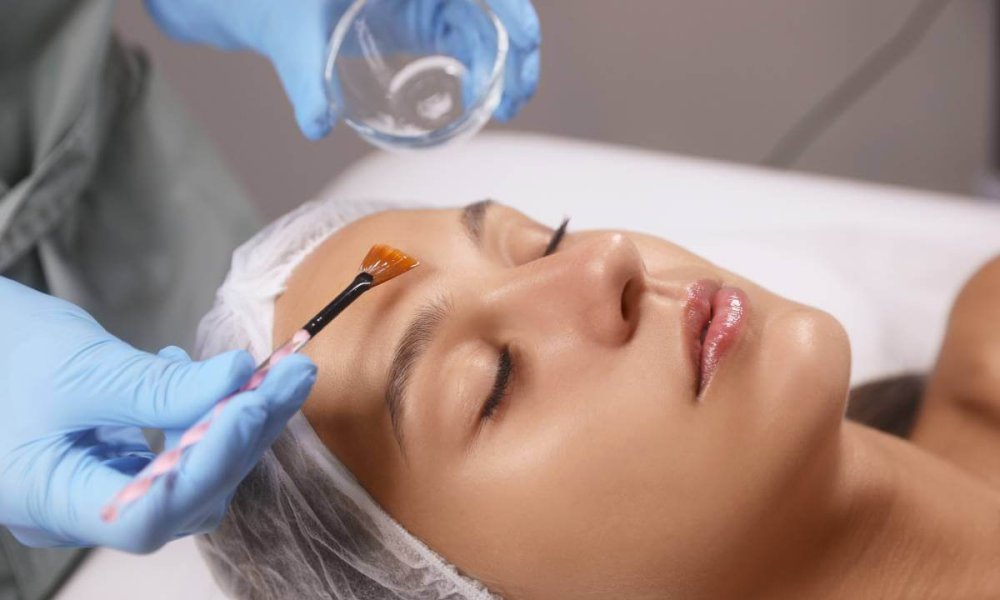 Chemical Peel with VI Peel _ Haus of Well, PC _ Riverside CA