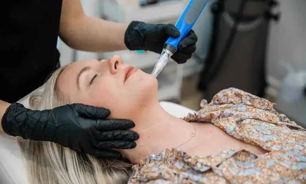 Microneedling with PRP in Riverside, CA by Haus of Well