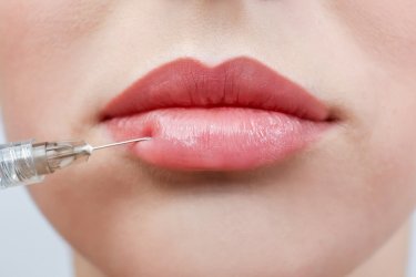 Beautiful young woman receiving filler injection in lips, closeup