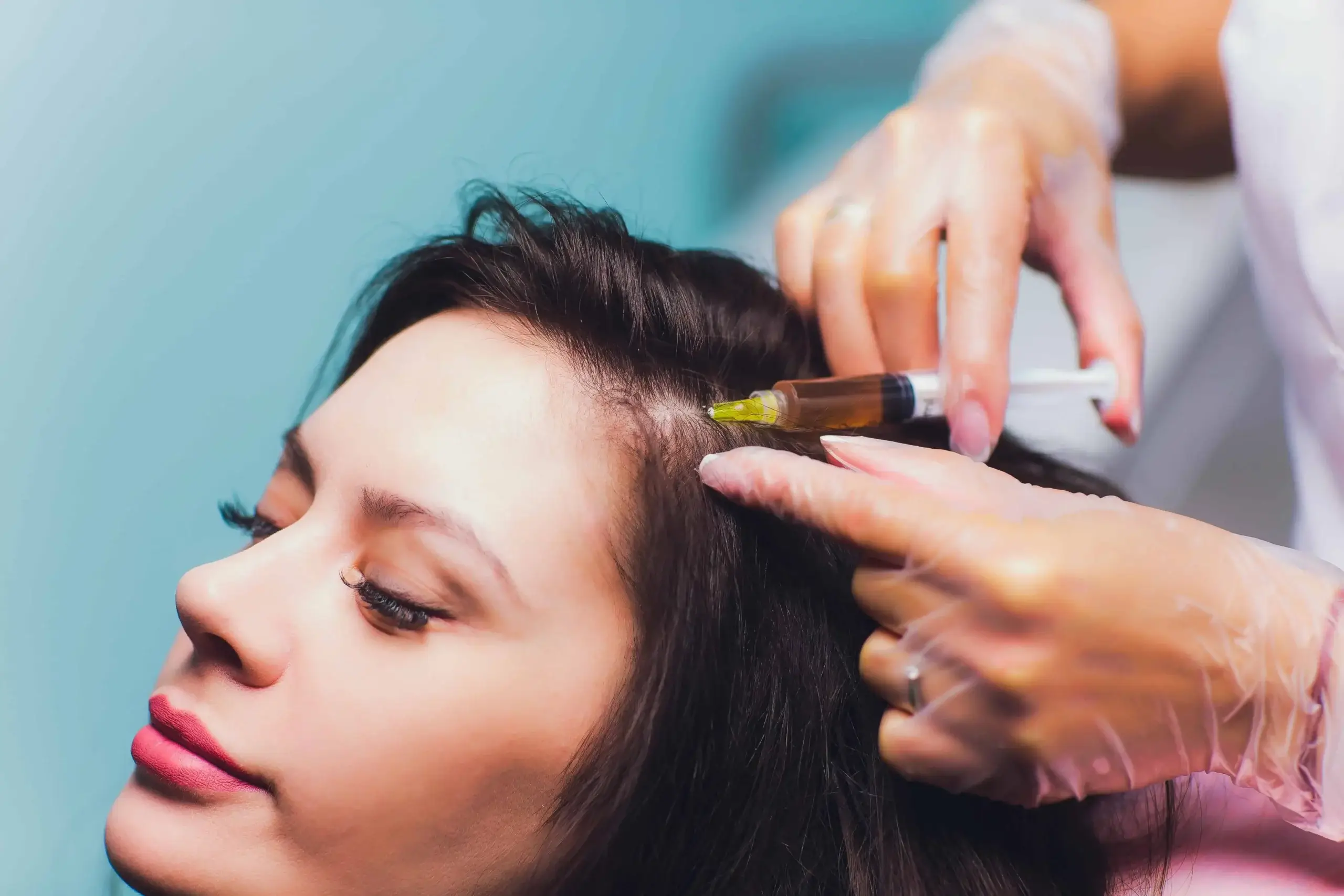 Microneedling with PRP in Riverside, CA - Haus of Well